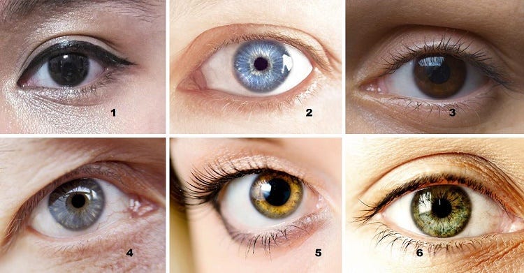 Different Eye Color
